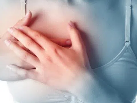 Bị u vú có được uống collagen hay không?