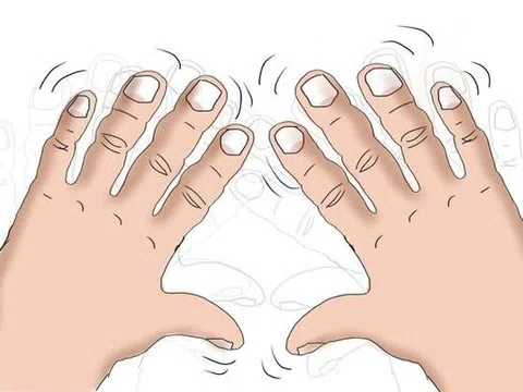 Run tay khó chữa - Giải pháp nào giúp người bệnh lấy lại tự tin trong cuộc sống?