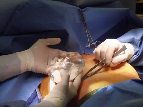 TP. Hồ Chí Minh: Lời khai của bác sĩ chở thi thể cô gái nâng ngực tử vong về Trà Vinh