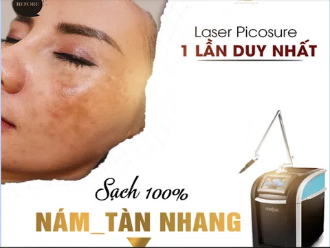 Bí kíp trị nám tàn nhang chỉ 1 lần duy nhất bằng công nghệ Laser Picosure tại Thẩm mỹ viện Bắc Âu Thanh Hóa