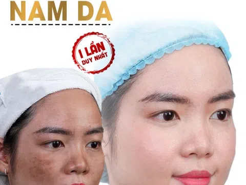 Thẩm mỹ viện rose điều trị nám hiệu quả an toàn nhất hà nội