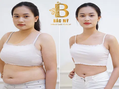 Thẩm mỹ viện quốc tế Bắc Mỹ giảm béo 1 lần lấy lại tuổi đôi mươi