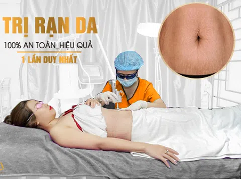 Chỉ 1 lần duy nhất xóa sạch 99% rạn da tại Thẩm Mỹ Viện Quốc Tế Bắc Âu