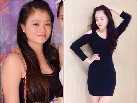 Thẩm mỹ viện quốc tế Bắc Mỹ giảm béo sau sinh một lần duy nhất