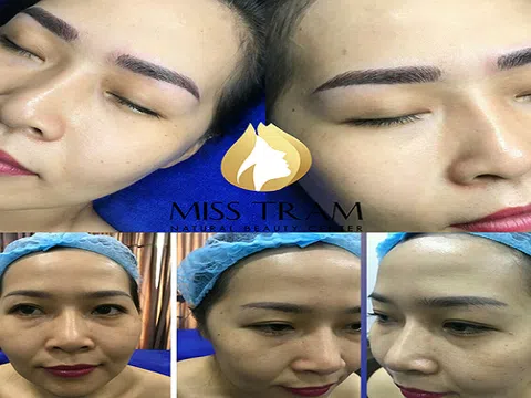 Ưu nhược điểm các phương pháp sửa chân mày phun xăm điêu khắc hỏng