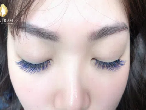 Các yếu tố tác động đến thời gian giữ mi nối