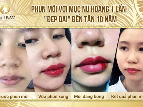 Ưu nhược điểm của các kỹ thuật phun môi: phun môi, điêu khắc môi