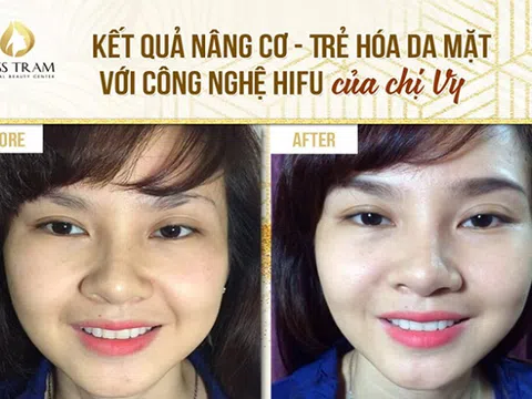 Thẩm mỹ viện chuyên làm trẻ hóa da an toàn tại TPHCM