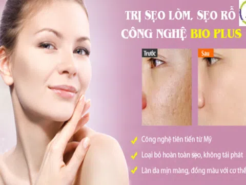 Thẩm mỹ viện quốc tế Bắc Âu điều trị sẹo 1 lần duy nhất