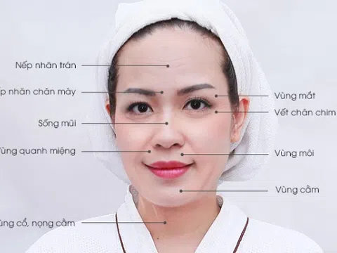 Thẩm mỹ viện quốc tế Bắc Mỹ nâng cơ trẻ hóa lấy lại tuổi thanh xuân