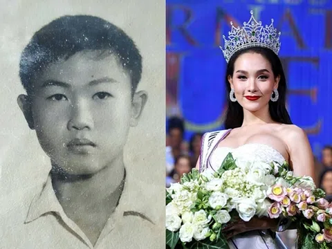 Tìm hiểu về nâng ngực chuyển giới