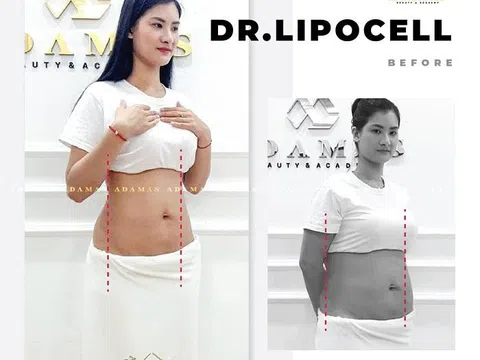 Những cách để giảm cân nguy hiểm nhất mọi thời đại