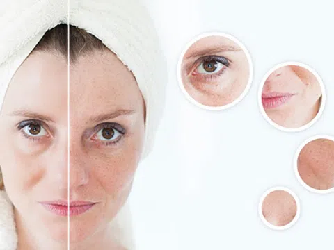 Giữ mãi dung nhan trẻ trung như tuổi 20 nhờ phương pháp chăm sóc da mới này