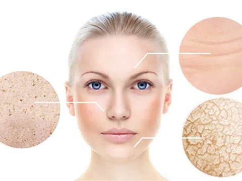 Công nghệ trẻ hóa làn da với máy RG - Phương pháp được đông đảo chị em áp dụng