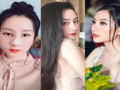 Nâng mũi theo phong thuỷ đang được ưa chuộng nhất hiện nay