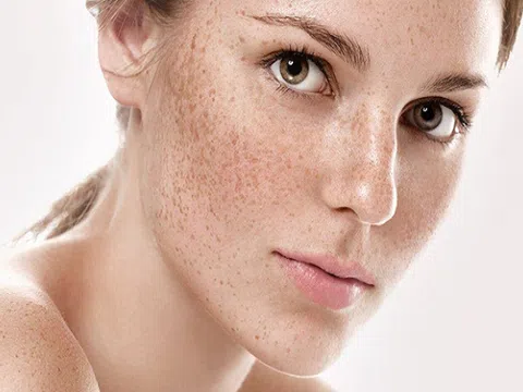 Nội tiết tố ảnh hưởng đến làn da phái đẹp thế nào?