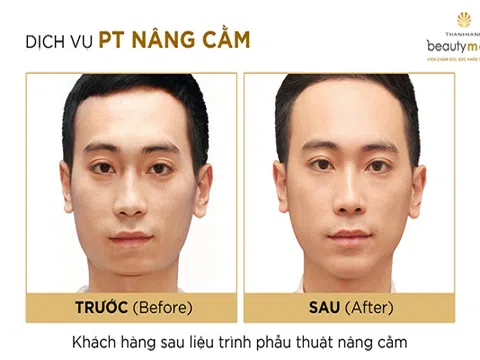 Khuôn mặt thanh tú nhờ sở hữu dáng cằm chuẩn tỷ lệ vàng