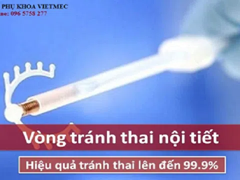 Vòng tránh thai nội tiết MIRENA