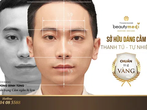 Cằm đẹp tự nhiên, không còn khuyết điểm