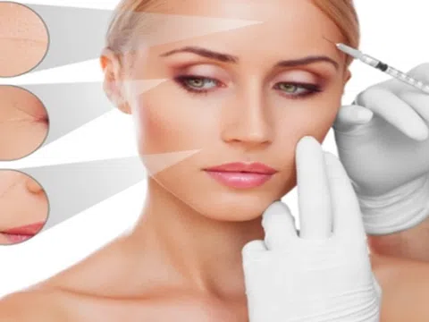 Tiêm filler đuôi mắt là gì? Có gây biến chứng không?