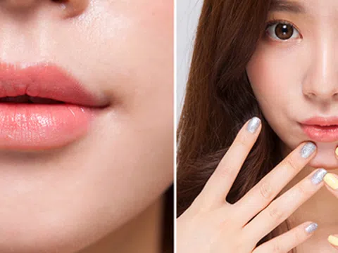 Tiêm filler khóe cười – xu hướng làm đẹp mới hiện nay