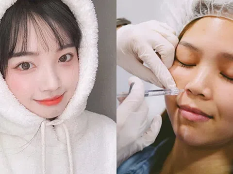 Tiêm filler rãnh cười, tại sao nên tiêm filler rãnh cười?