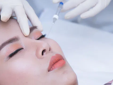 Tiêm filler rãnh lệ là gì? Có hại không?