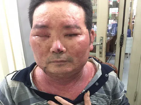 Hậu họa khi tiêm thuốc 'thần dược' điều trị viêm da