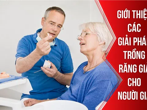 Giới thiệu các giải pháp trồng răng giả cho người già