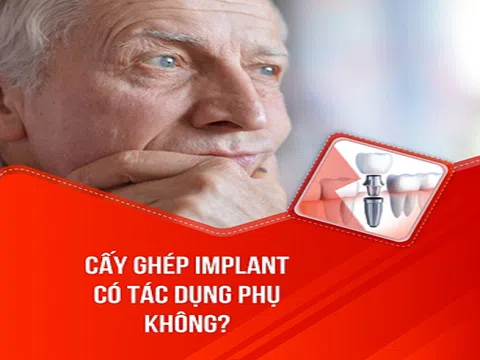 Cấy ghép răng Implant có tác dụng phụ không?