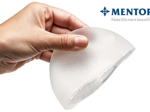 Phương pháp nâng ngực mentor giá bao nhiêu tại Việt Nam?