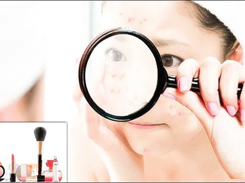Mùa hè, đề phòng dị ứng mỹ phẩm