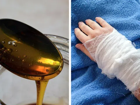 10 cách chữa lành vết thương tại nhà