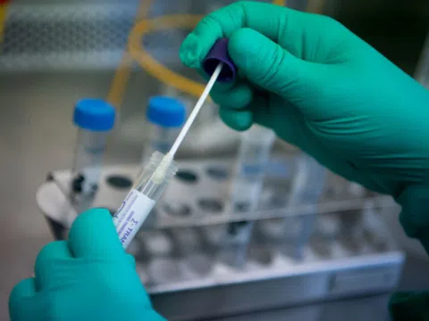 Việt Nam ghi nhận thêm 11 ca dương tính với COVID-19, nâng tổng số bệnh nhân lên 134