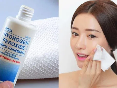 Hướng dẫn sử dụng Oxy già trong điều trị mụn trứng cá tại nhà