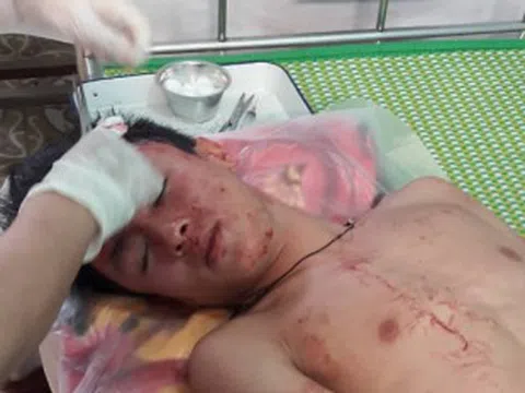 Hà Nội: Cần xử lý nghiêm nhóm đối tượng hành hung người trong đêm