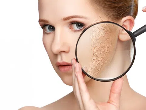 Chuyên gia da liễu chỉ cách chăm sóc da mùa hanh khô