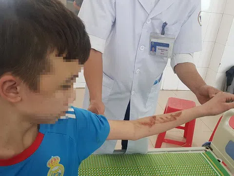 Vụ 2 nhân viên bị bạo hành ở Bắc Ninh: Cục trẻ em lên tiếng