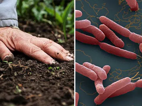 Sự thật về bệnh Whitmore - Hiểu đúng để phòng ngừa sớm