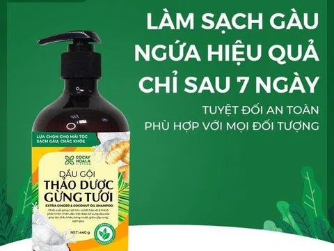 Tự ti với mái tóc bết gàu, cô gái trẻ đã lấy lại tự tin chỉ sau 3 tháng trải nghiệm dầu gội thảo dược