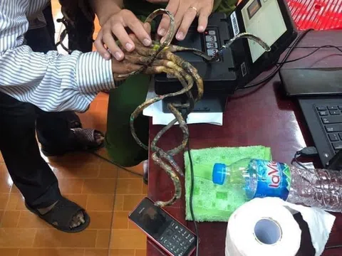 Vợ của “dị nhân” có bộ móng tay dài nhất VN tiết lộ điều đáng sợ nhất sau 40 năm sống chung