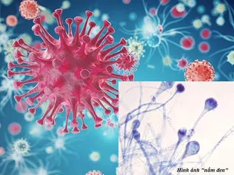“Nấm đen” và COVID-19: Lầm tưởng và sự thật