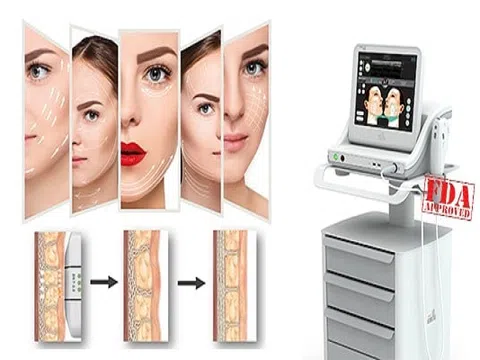 Mãi mãi tuổi thanh xuân- Với bí quyết chống lão hóa hoàn hảo tại thẩm mỹ viện Bắc Âu