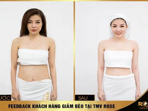 Chính thức ra mắt công nghệ giảm béo anh quốc Smart Burn Fast 2020 Tại Thẩm mỹ viện Rose