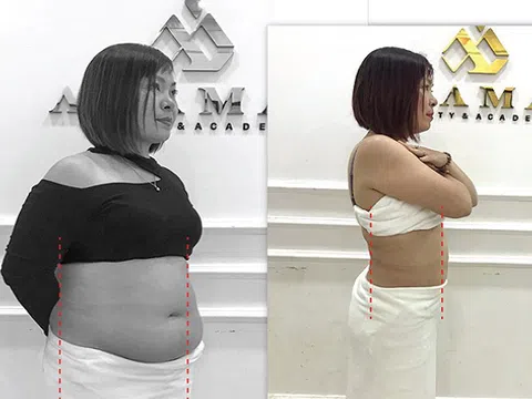 Doanh nhân U40 bật mí cách giảm mỡ bụng nhanh sau 7 ngày