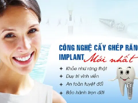 Trồng răng nhân tạo bằng công nghệ Implant Dental