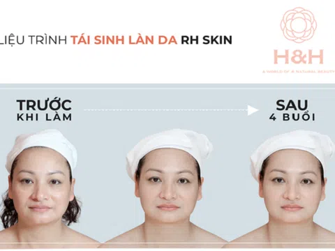RH - Skin - Thành tựu siêu tái sinh trẻ hoá làn da của Nhật Bản - Lần đầu có mặt tại Việt Nam