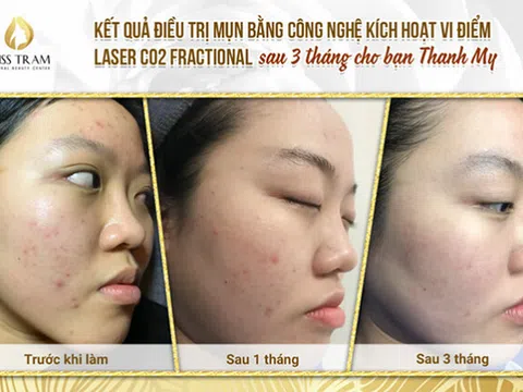 Nên đắp mặt nạ trái cây cho da mụn hay không?