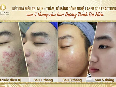 Top 6 điều lưu ý khi chăm sóc da tại Spa, Thẩm mỹ viện