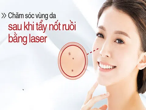 Hướng dẫn chăm sóc da sau khi tẩy nốt ruồi bằng Laser